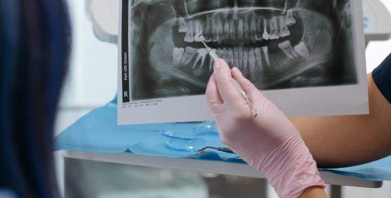 Who to Call in Case of a Dental Emergency Outside Office Hours?